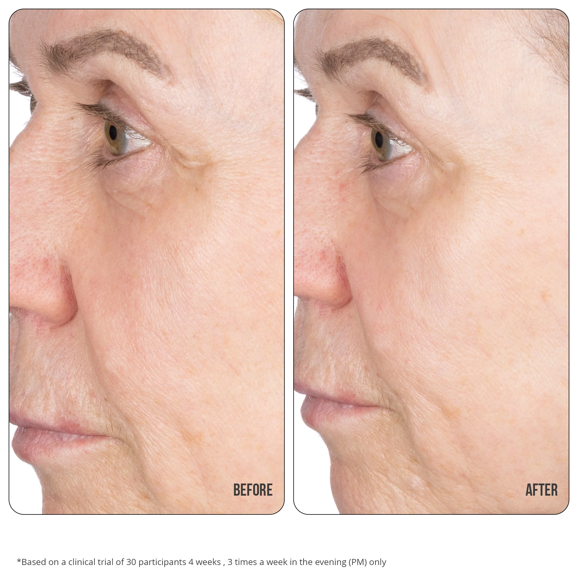 Retinol Fix Concentrate Extreme 10% 30ml - Image 4