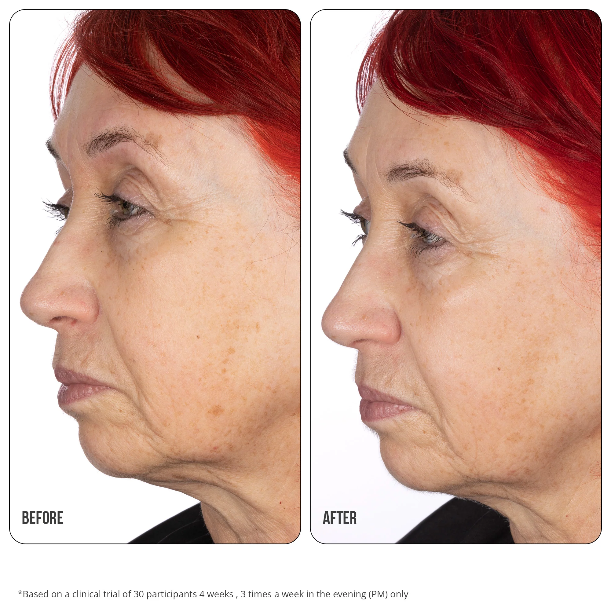 Retinol Fix Concentrate Extreme 10% 30ml - Image 5