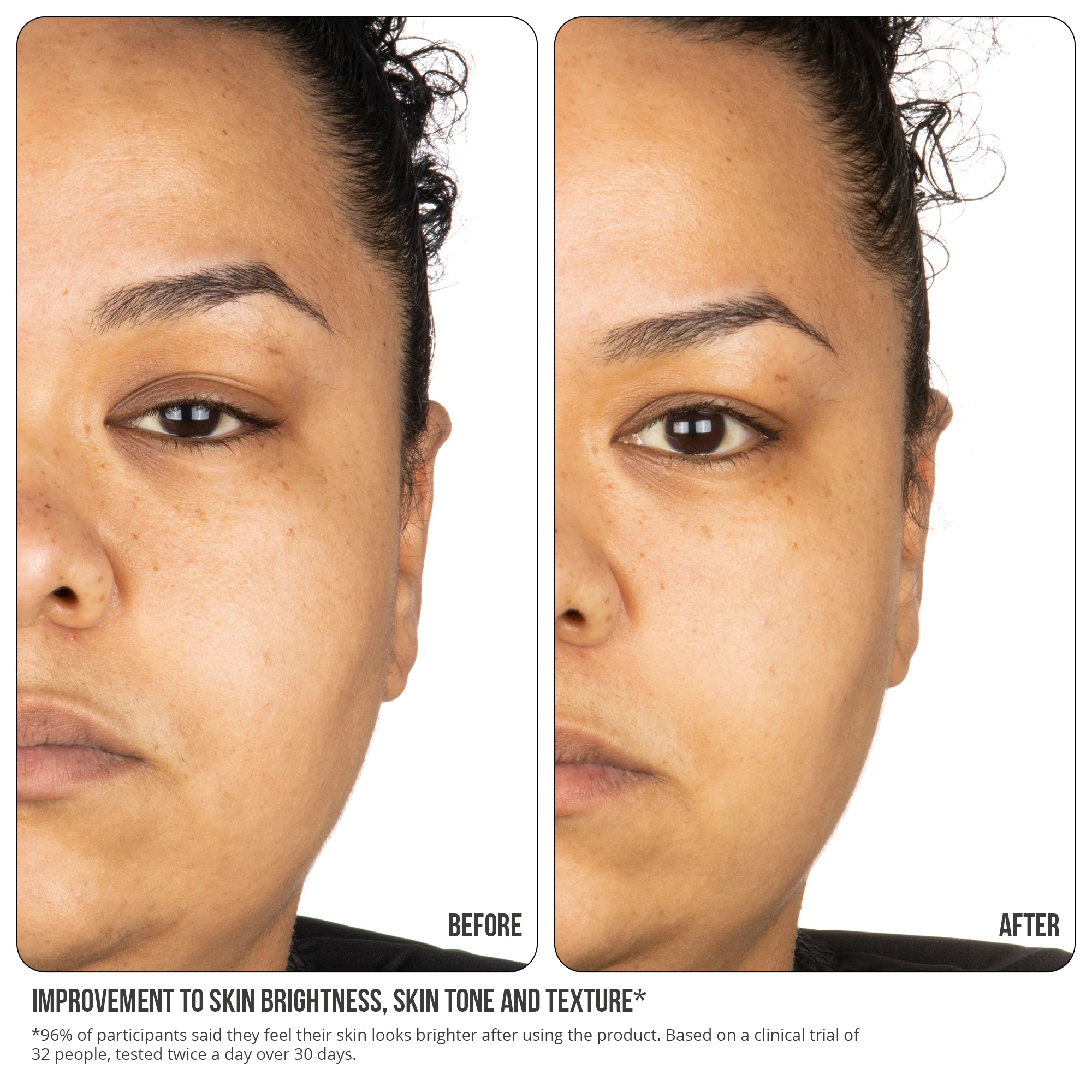 Vitamin C Fix Concentrate Extreme 15% 30ml - Image 9